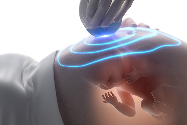 realistic moving image at bump baby imaging Maitland