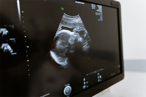 3D/4D/5D Pregnancy Ultrasound & Gender Reveal