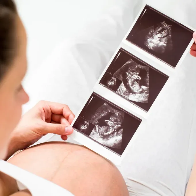 Pregnant woman reviewing baby ultrasound scan